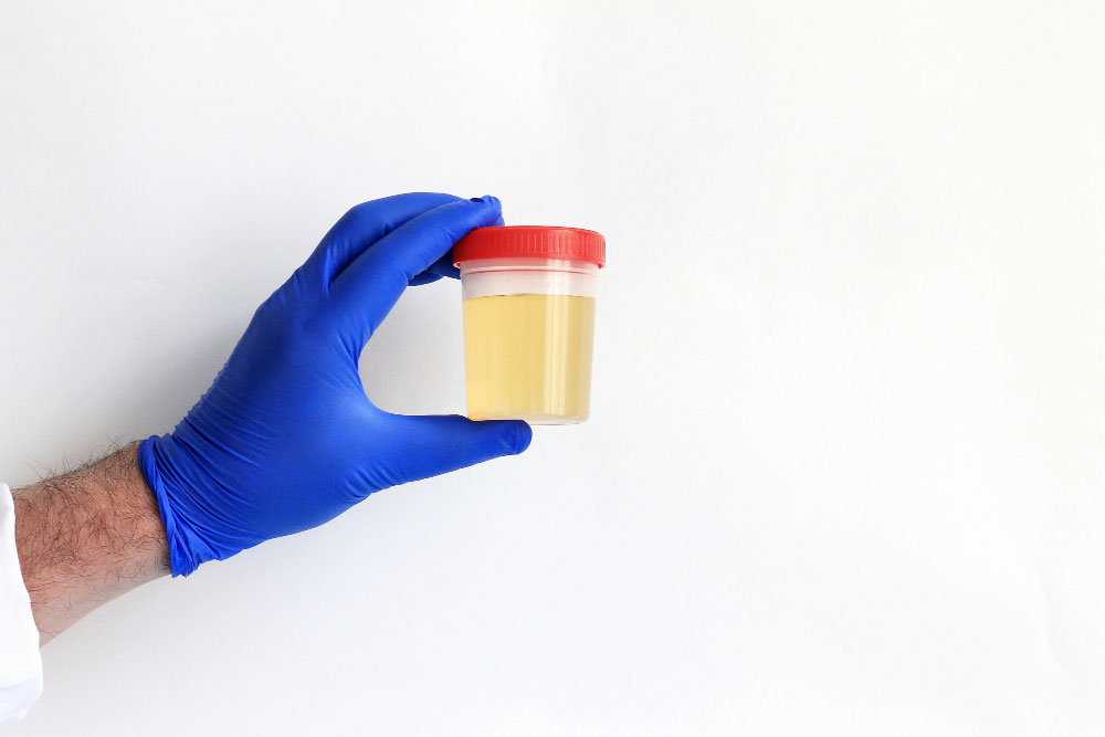 Disposable-Syringes-&-Needles